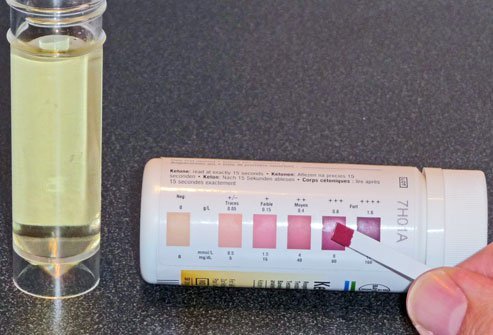 Make sure you’re using your ketone strips regularly, and that they have not expired.