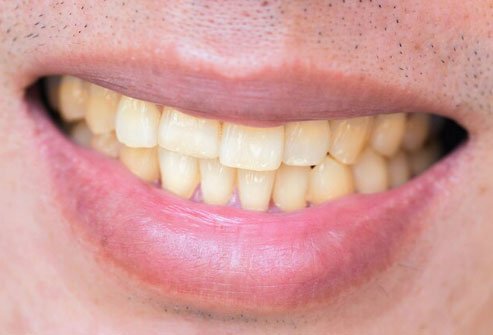 A few studies show that toothpaste with baking soda whitens your teeth better than the kind without it.