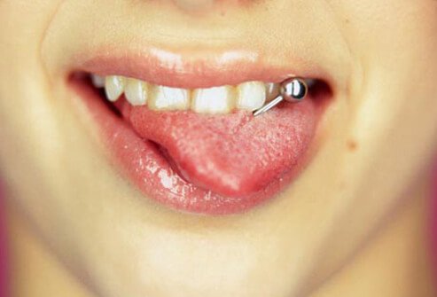 . Discouraged by dentists, tongue piercings can cause lots of teeth problems, and mouth problems overall.