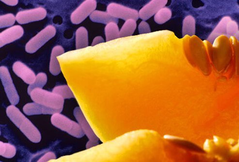 Listeria