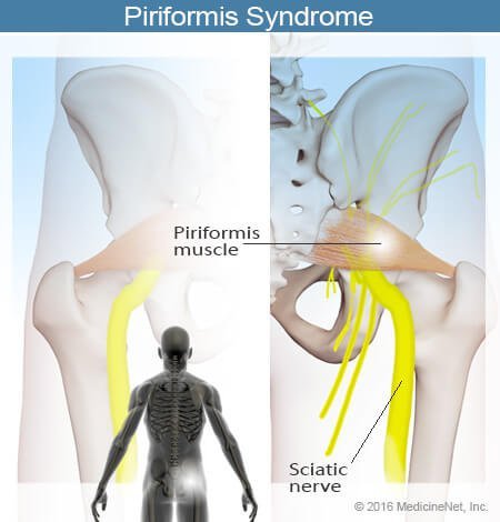 Picture of the piriformis muscle