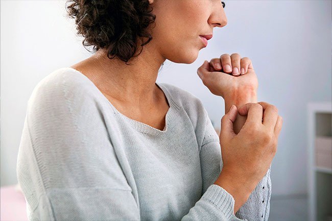 Use cold compresses, moisturizers, and medicated creams to soothe eczema. 