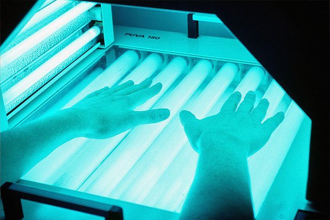 UV light with psoralen may help moderate to severe causes of eczema. 