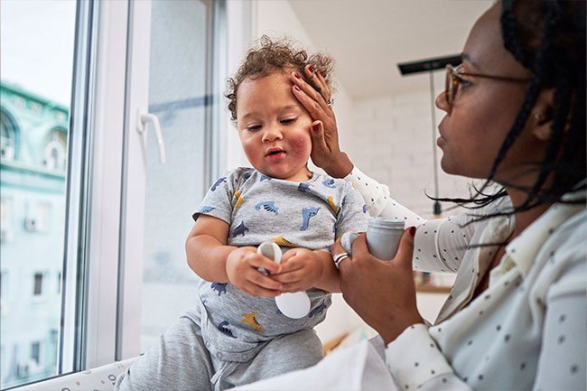 Babies who have atopic dermatitis may grow up into adults who have eczema. 