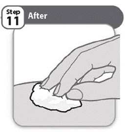 Use a clean cotton ball or gauze pad to press lightly on the injection area - Illustration