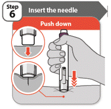 Insert the needle - Illustration