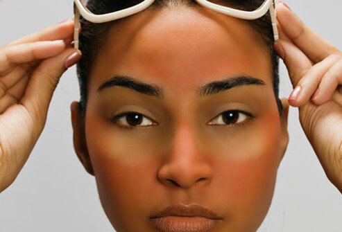 Sun exposure can be dangerous for your skin.