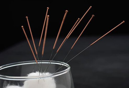 Acupuncture needles