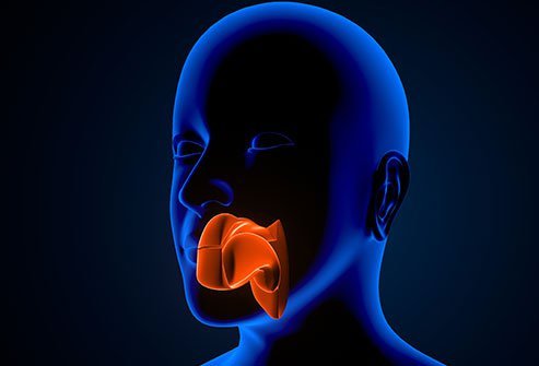 Adenoid cystic carcinoma typically affects the salivary glands.