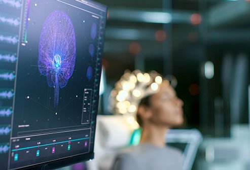 Video EEG (electroencephalogram) monitoring is a specialized kind of real-time brain imaging used for diagnosing the cause of seizures. The patient is continuously monitored on a video while an EEG unit records their brain activity.
