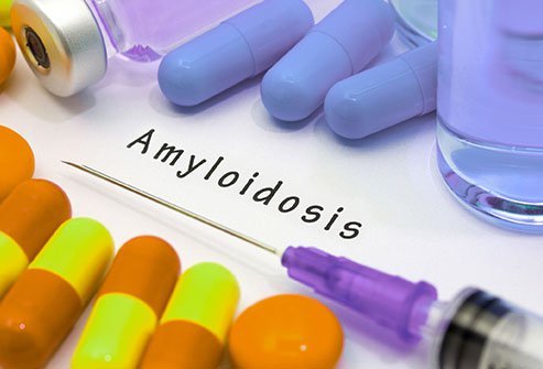 Amyloidosis develops as a result of abnormal protein deposits in various organs and tissues.