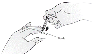 When the syringe is empty, pull the
needle out of the skin while carefully keeping the needle at the same angle as
inserted - Illustration