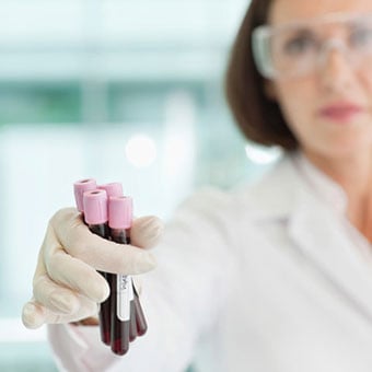 Gloved hand holding test tubes filled with blood.