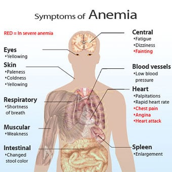 Symptoms of Anemia chart