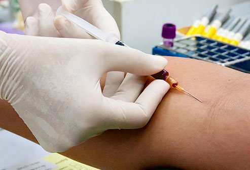Diagnosis of AS may take some time. The doctor will evaluate you, perform a physical exam, and take your medical history.