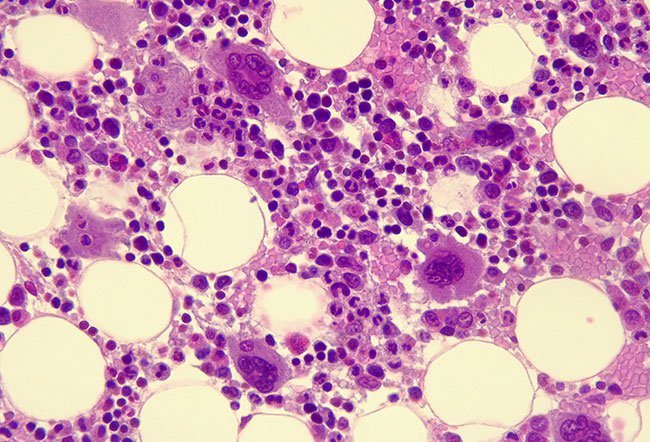Osteoblasts when transformed into osteocytes become mature bone cells.