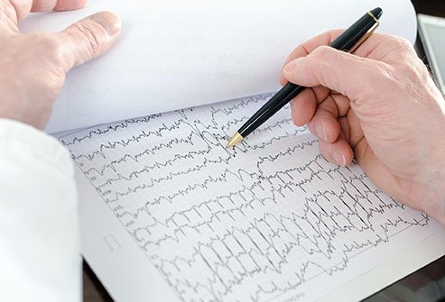 Picture of a doctor studying an EKG readout.