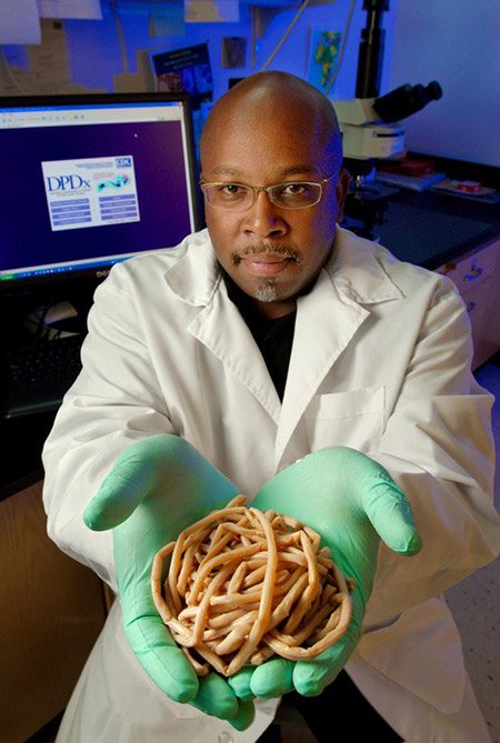 Mass of Ascariasis lumbricoides worms