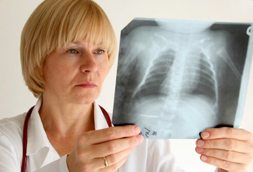 Asthma is a chronic lung disorder that can make breathing difficult.