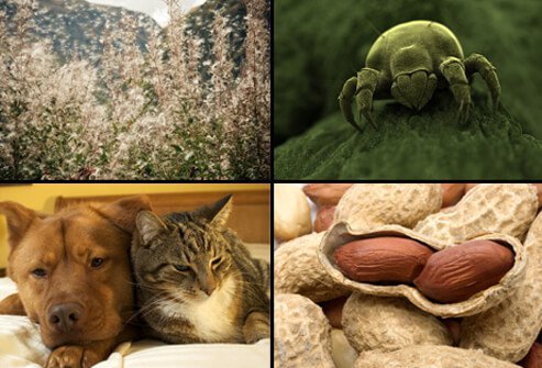 Allergic asthma triggers include many allergens.