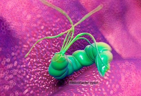 Sometimes stinky breath comes from a stomach bacteria.