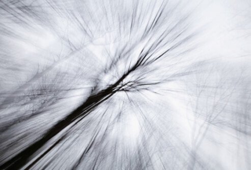 Vestibular neuronitis is an inflammation of the vestibular nerve and may be caused by a virus. 