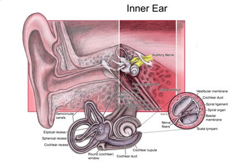 Perilymph fistula is a leakage of inner ear fluid into the middle ear.