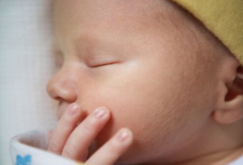 Newborn skin is far from flawless but it usually doesn't mean something is wrong.
