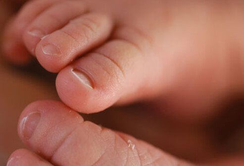 You likely don't need lotions or creams during baby's first month.
