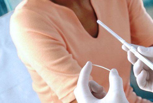 The same hormone in the birth control shot can be delivered in an implant.