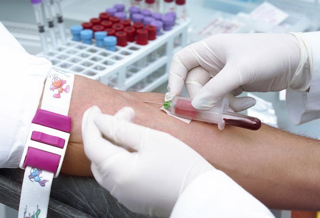 can Lyme disease be detected by a blood test can Lyme disease be detected by a blood test