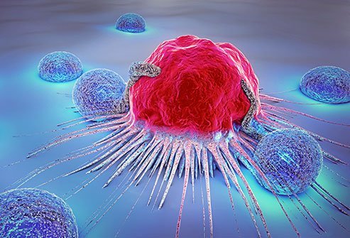 The cancers are caused by a sudden mutation (changes) in the cell genetic material (deoxyribonucleic acid or DNA). The exact cause of such mutation is unknown.