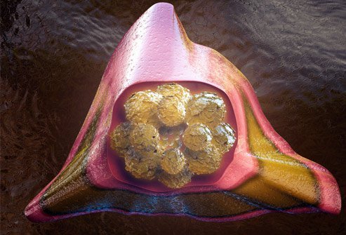 Pictured is an illustration of a healthy bone marrow cell -- the kind doctors harvest from donors to use in bone marrow transplantation.
