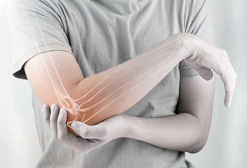 A fracture is a break in your bone or cartilage. Broken bones hurt. The pain may be so severe that you may be unable to move the affected area. A fracture is a break in your bone or cartilage. Broken bones hurt. The pain may be so severe that you may be unable to move the affected area.