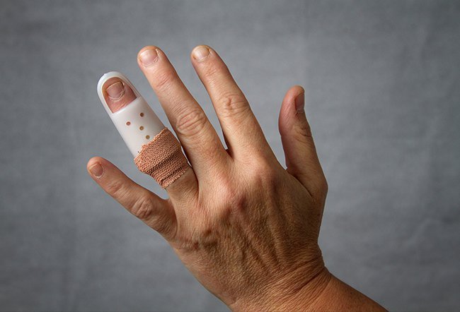 what is the fastest way to heal a jammed finger