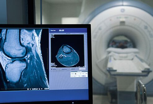 Bursitis can be diagnosed by a doctor based on a medical history, exam and tests.