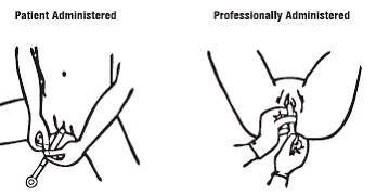 Inserting the Applicator - Illustration