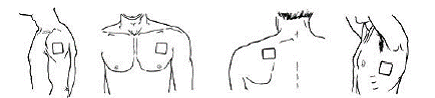 Percent Reduction in Pain Intensity - Illustration
