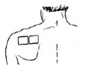 BUTRANS should be applied to the upper outer arm, upper chest, upper back, or the side of the chest - Illustration