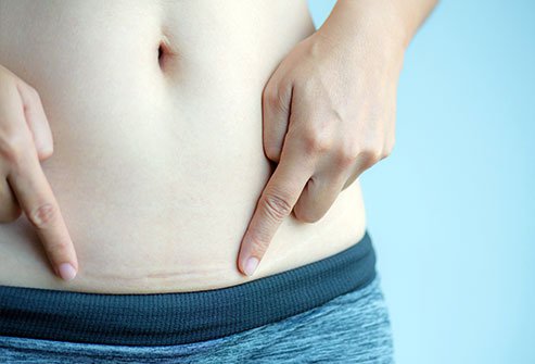 Cesarean delivery is the surgical delivery of a baby by cutting open the belly and womb.