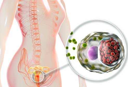 So much wrong information about chlamydia