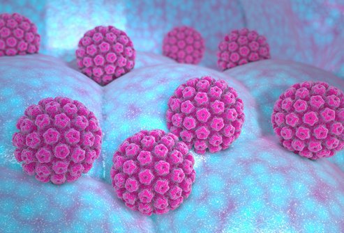 HPV can appear as noncancerous tumors called warts or papillomas. High-risk HPV does not usually have any symptoms and can develop into cancer.