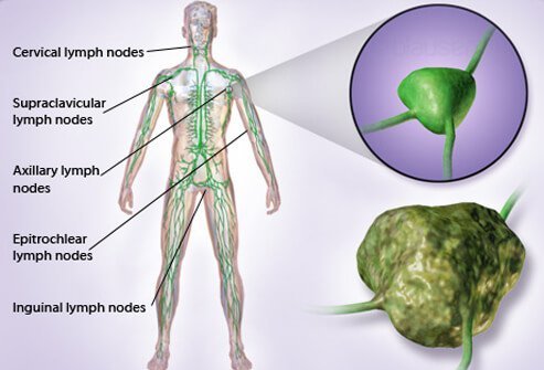 Illustration shows the location of lymph nodes in the body. 