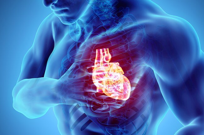 Cardiac arrest, sometimes called sudden cardiac arrest, means that your heart suddenly stops beating.
