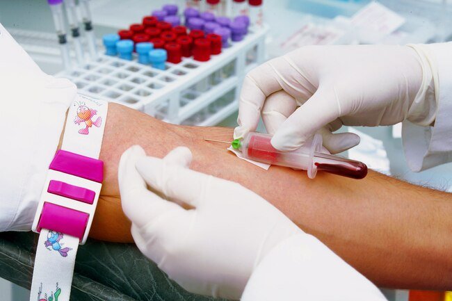 You might get blood tests and other types of studies to check on your heart.