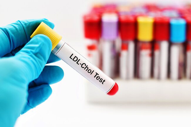 Exercise seems to raise your HDL (good) cholesterol. 