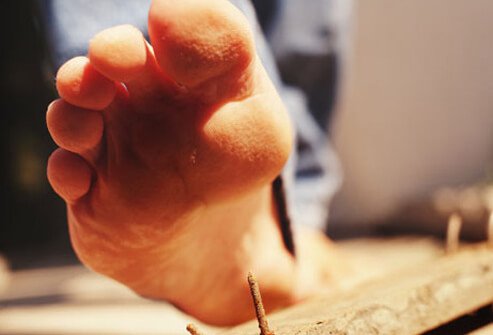 It is fine to treat minor cuts and scrapes at home, but you should seek medical attention for injuries that are more severe.