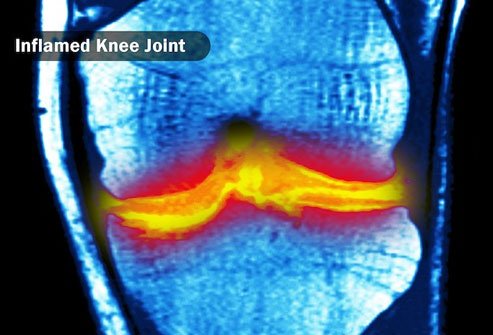 Research on CBD's potential anti-inflammatory effects is ongoing. 