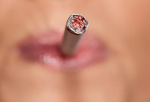 Women of Hispanic or African American ethnicity have a higher risk of cervical cancer than Caucasian women.