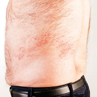 Nerves and muscles can cause chest pain as well as illnesses like the shingles virus.
